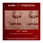 L'Oreal Paris Revitalift Laser Κρέμα Ημέρας Δραστικης Αντιγήρανσης 50Ml - Image 4