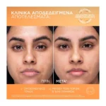 L'Oreal Paris Revitalift Clinical Vitamin C Καθημερινη Κρέμα Προστασίας Με Uv 50Ml - Image 7