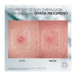 Derma Control S.O.S. Pimple Paste - Image 7