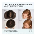Elvive Growth Booster Serum κατά Της Τριχόπτωσης 102Ml - Image 3