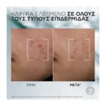 Derma Control Ορός κατά των ατελειών Με Νιασιναμίδη - Image 7